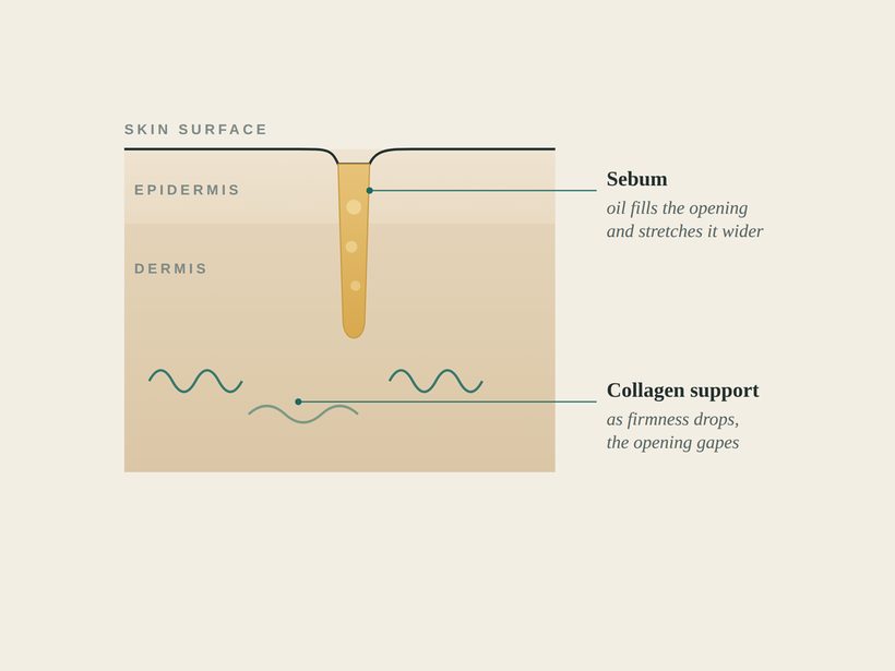 A clinical cross-section illustration of a skin pore in cream and teal, showing the follicle opening, sebum, and surrounding collagen scaffold